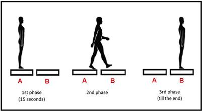 Transitional Locomotor Tasks in People With Mild to Moderate Parkinson's Disease